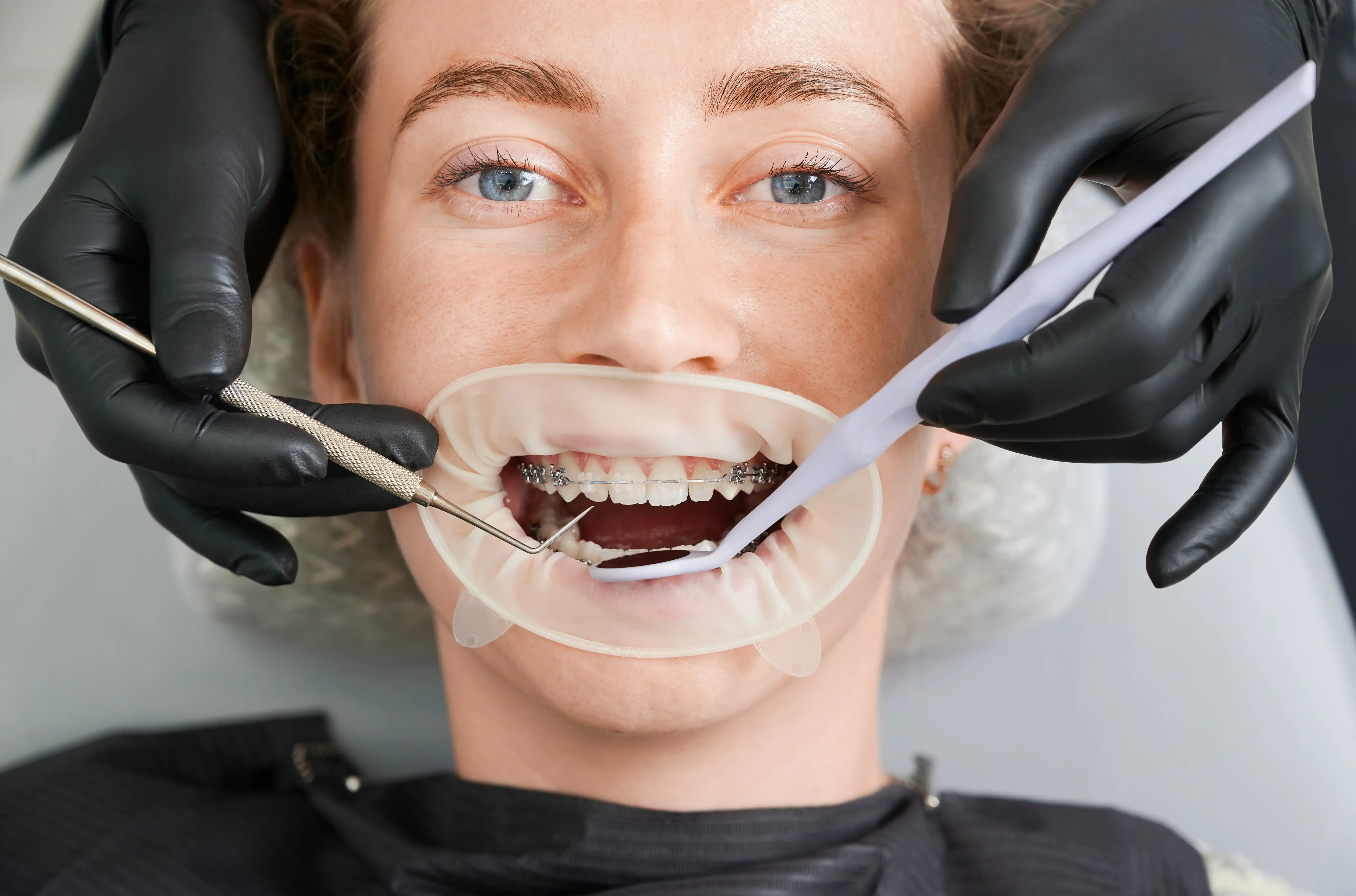 Dentística Restauradora